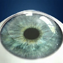 LASIK Center